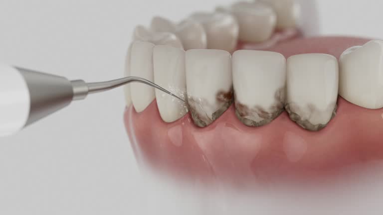 Reliable Tooth Extraction contractor in Forsyth County County, GA by Dentist Open Now